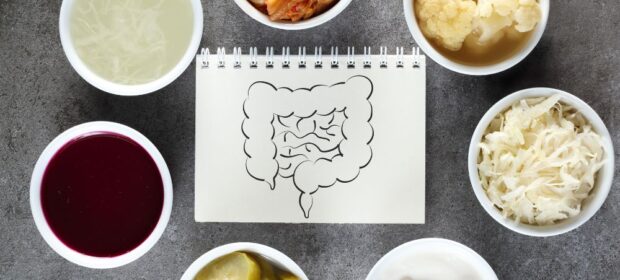 Best 6 Probiotic Foods That Can Boost Gut Health