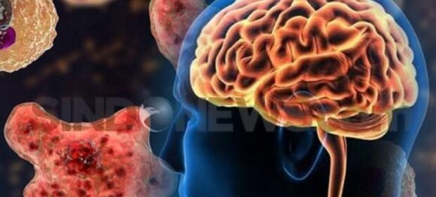 Steps Taken to Save Athletes From Brain-Eating Amoeba in Swimming Pools